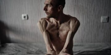 Росія посилює тортури українських полонених