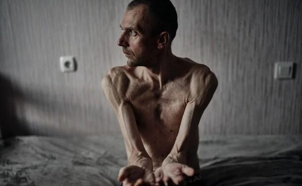 Росія посилює тортури українських полонених