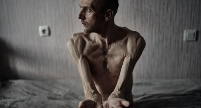 РФ офіційно впроваджує тортури як державну політику щодо полонених українців