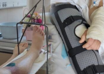 У Франківську чоловіку зламали руку й ногу та відвезли до ТЦК: омбудсман вимагає розслідування