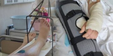У Франківську чоловіку зламали руку й ногу та відвезли до ТЦК: омбудсман вимагає розслідування