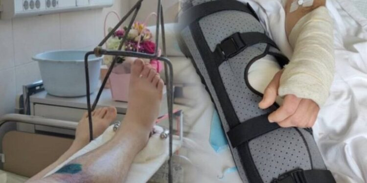 У Франківську чоловіку зламали руку й ногу та відвезли до ТЦК: омбудсман вимагає розслідування 1 У Франківську чоловіку зламали руку й ногу та відвезли до ТЦК: омбудсман вимагає розслідування
